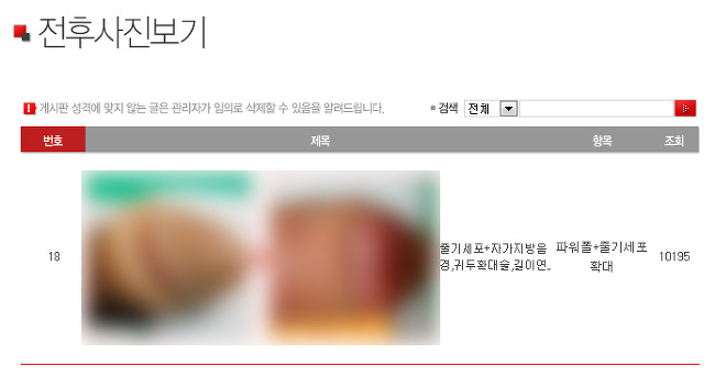 음경확대]맨비뇨기과 신도림역점 고객 음경확대 수술후기