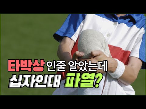 [십자인대파열/무릎] 타박상인 줄 알았는데, 십자인대파열이라고?