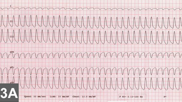 How Is Arrhythmia Treated In Cats: A Comprehensive Guide