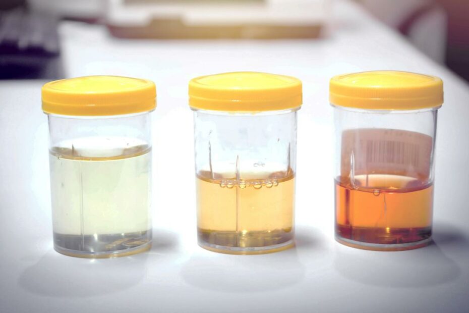 Medications That Can Change Your Urine Color - Goodrx