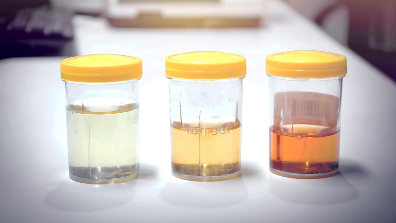 Medications That Can Change Your Urine Color - Goodrx