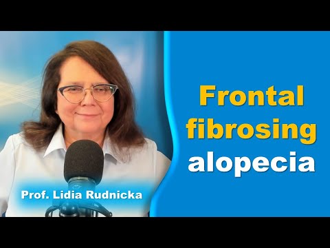 Frontal fibrosing alopecia